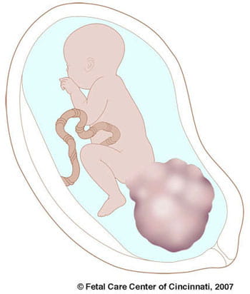 sct-visual-350x412-illustration